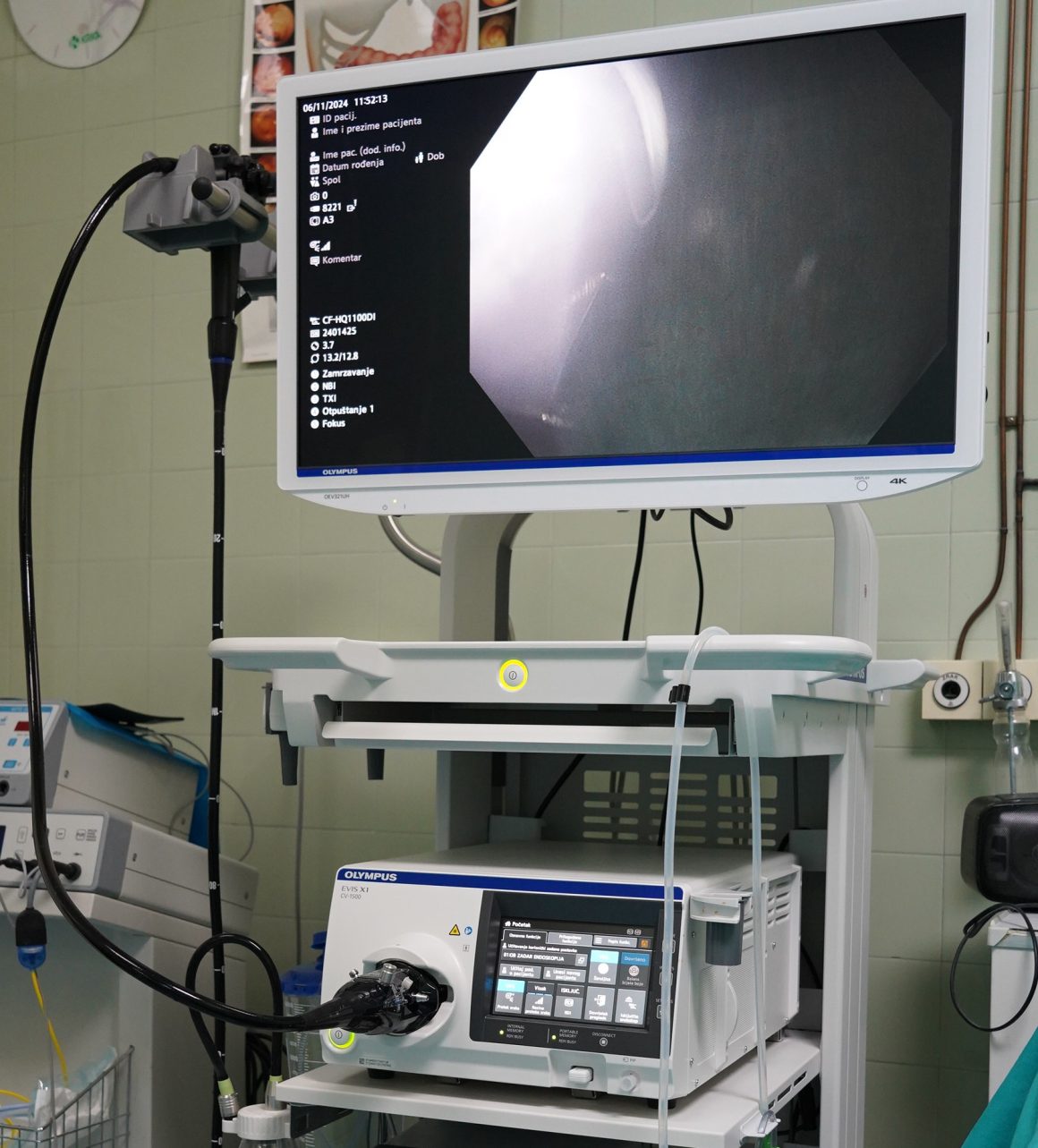 Izuzetno vrijedan uređaj instaliran na Odjel za gastroenterologiju OB Zadar
